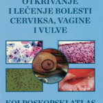 Otkrivanje i lečenje bolesti cerviksa, vagine i vulve - Kolposkopski atlas