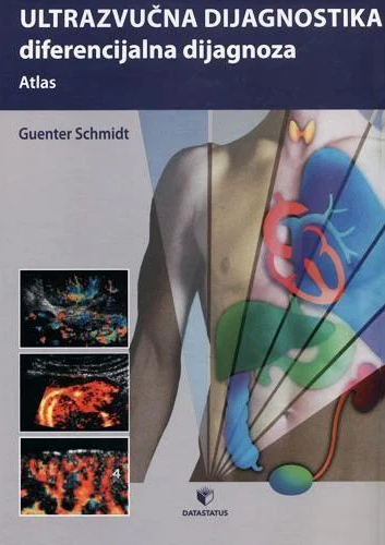 Ultrazvučna dijagnostika - diferencijalna dijagnoza, atlas Ultrazvučna dijagnostika - diferencijalna dijagnoza, atlas - Image 1