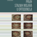 Ekstrakcija prvih stalnih molara u ortodonciji