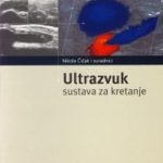 Ultrazvuk sustava za kretanje